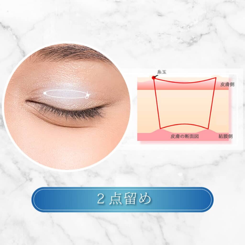 2点
