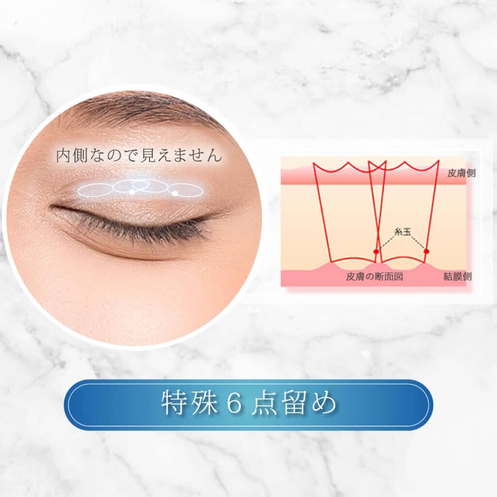 特殊6点