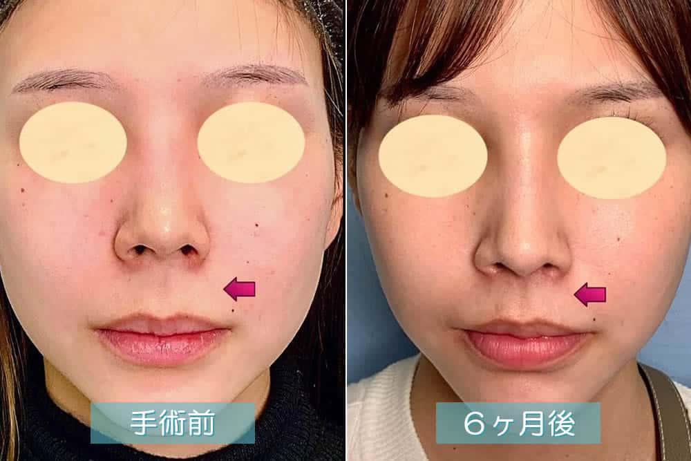 身長を下げる手術というものはあるのでしょうか?