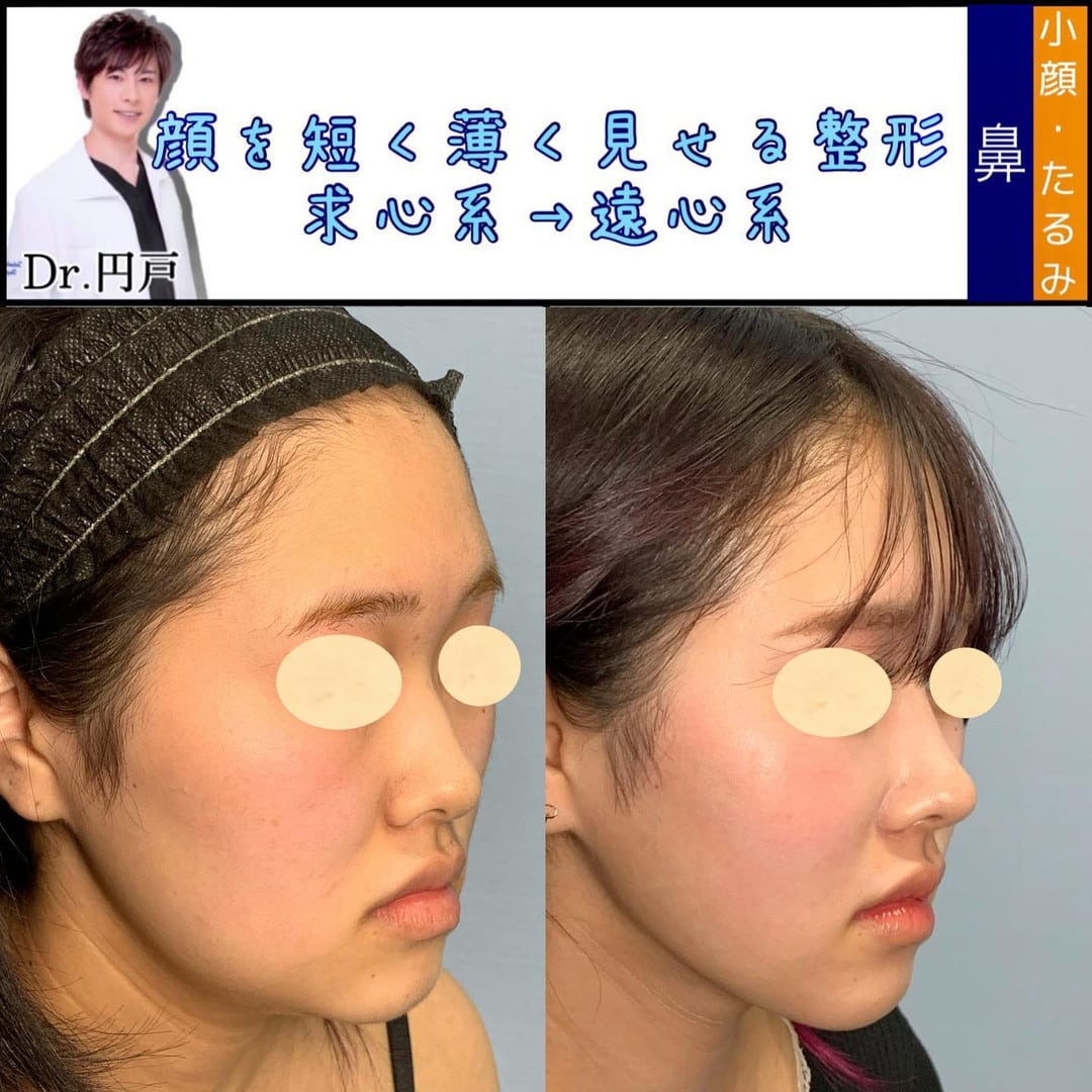 endo_eclinic2_287366496_815409