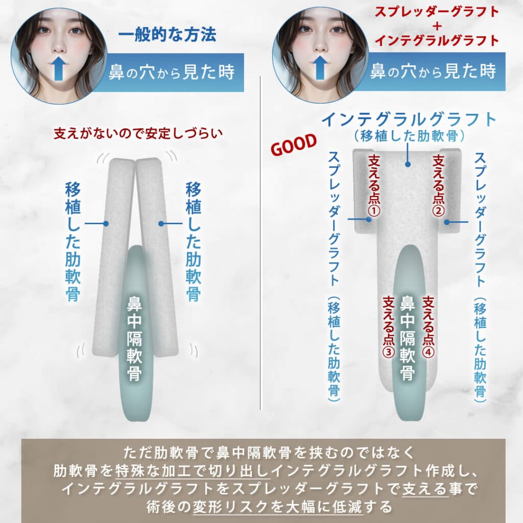 一般的な方法とインテグラルクラフトとスプレッダークラフトを組み合わせた方法の図解