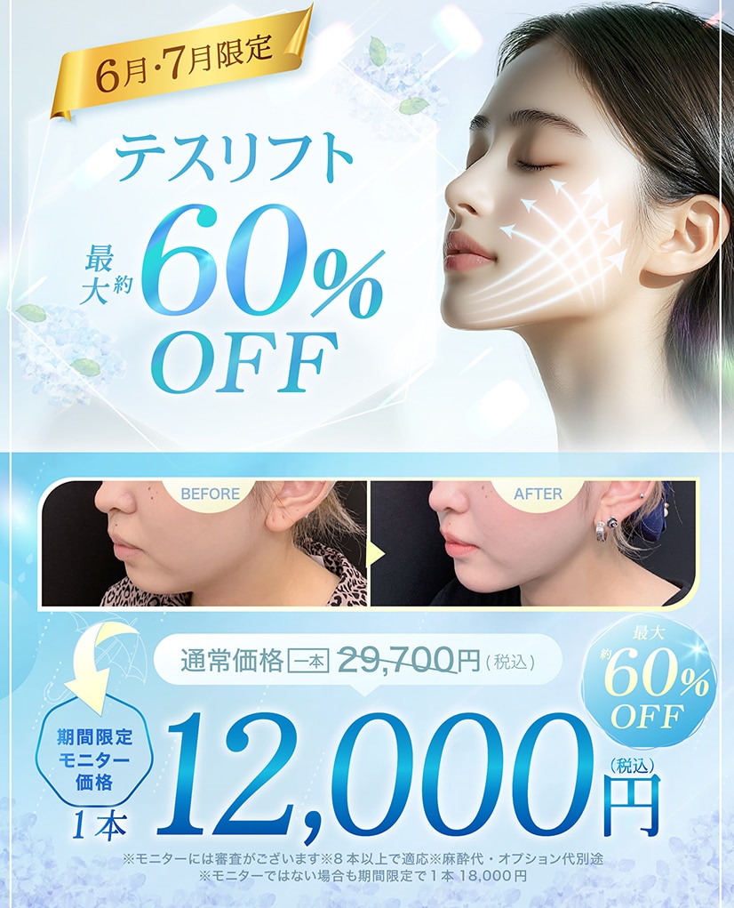 糸リフトのモニターキャンペーン