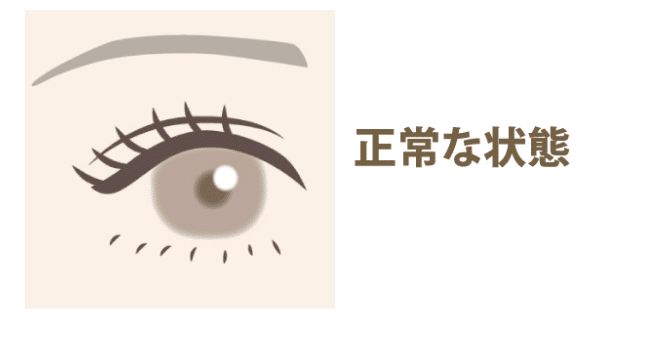 正常な目