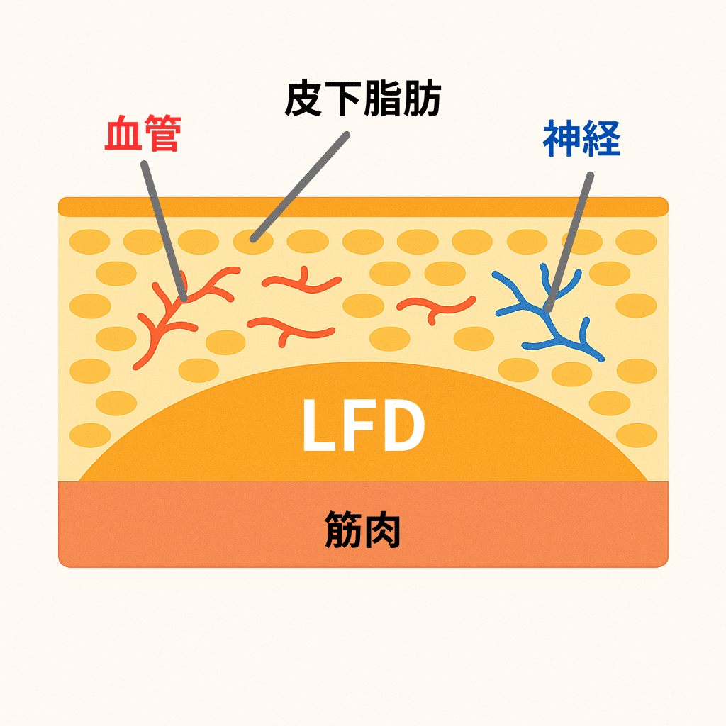 脂肪の種類 LFD