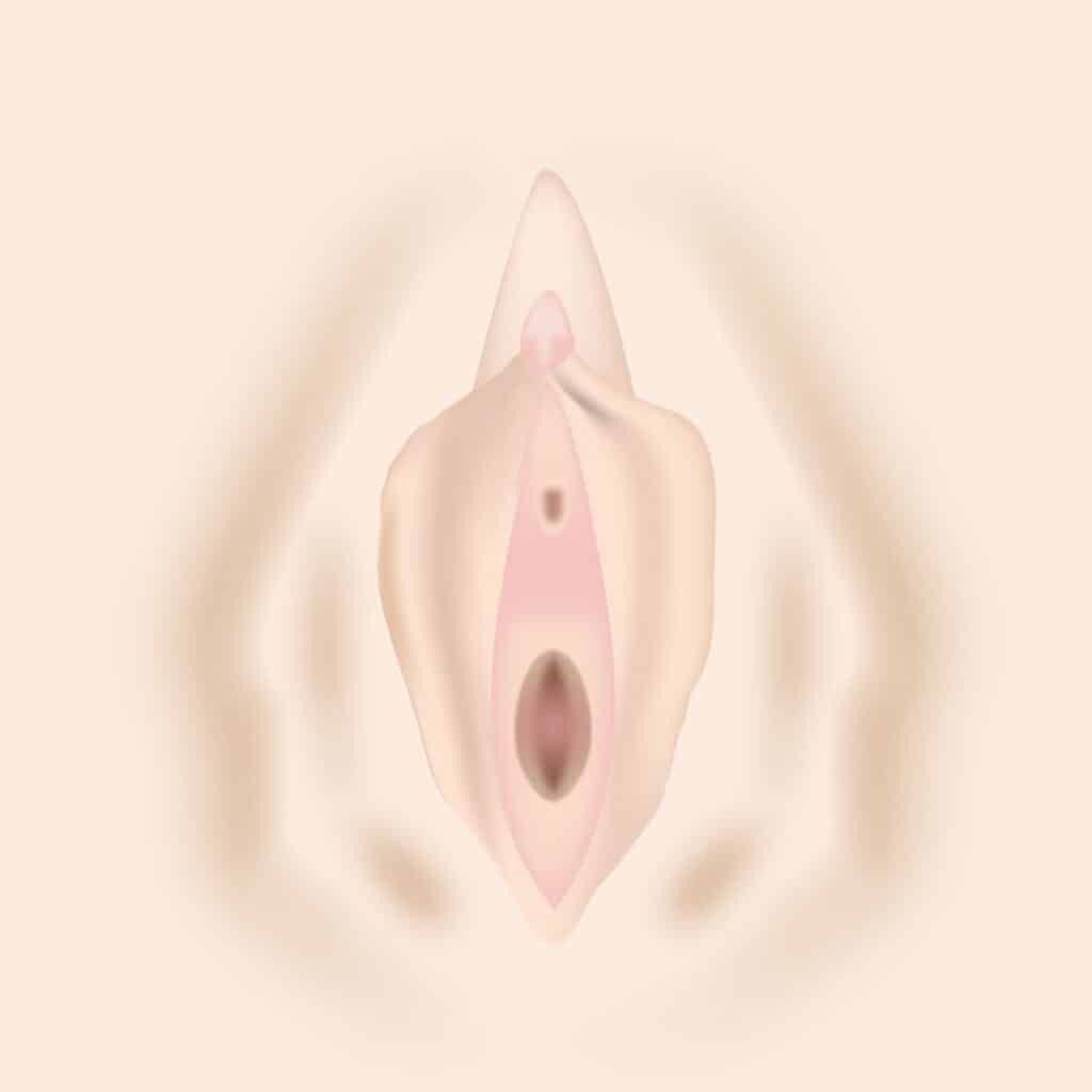 大陰唇がたるんでいる様子の図解