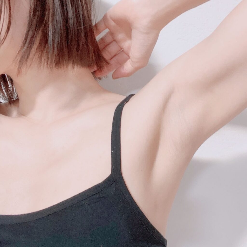 わきが治療「吸引シェービング法」