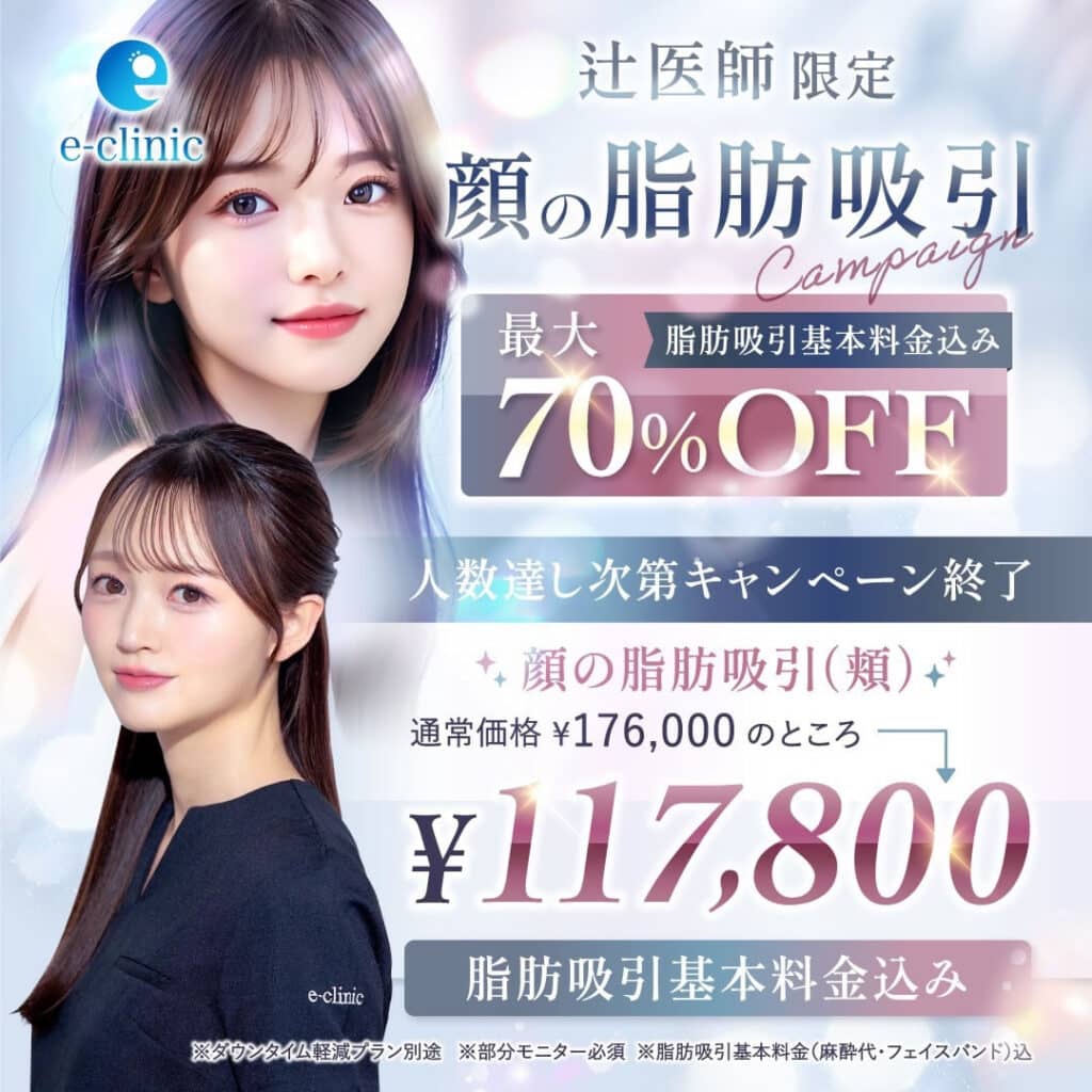 顔の脂肪吸引のバナー