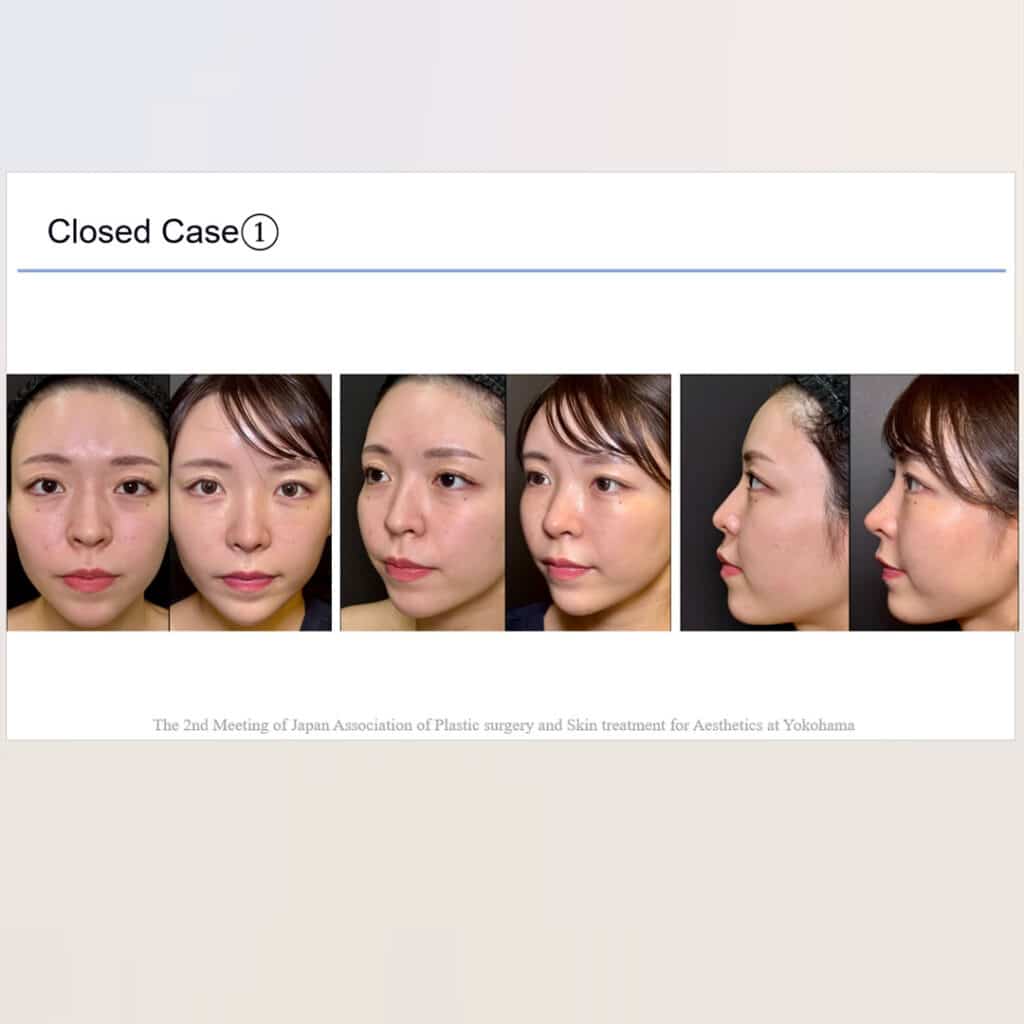 学会発表のスライド