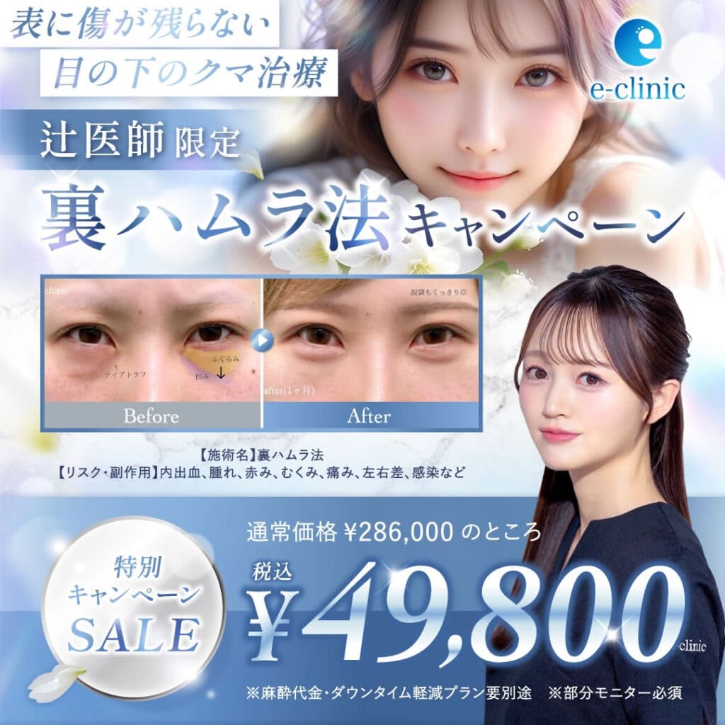 辻医師の裏ハムラ法のキャンペーンバナー