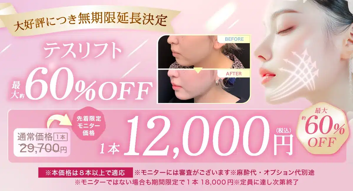 閑散期テスリフトCP