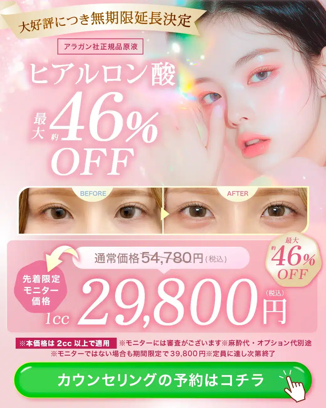 閑散期ヒアルロン酸CP