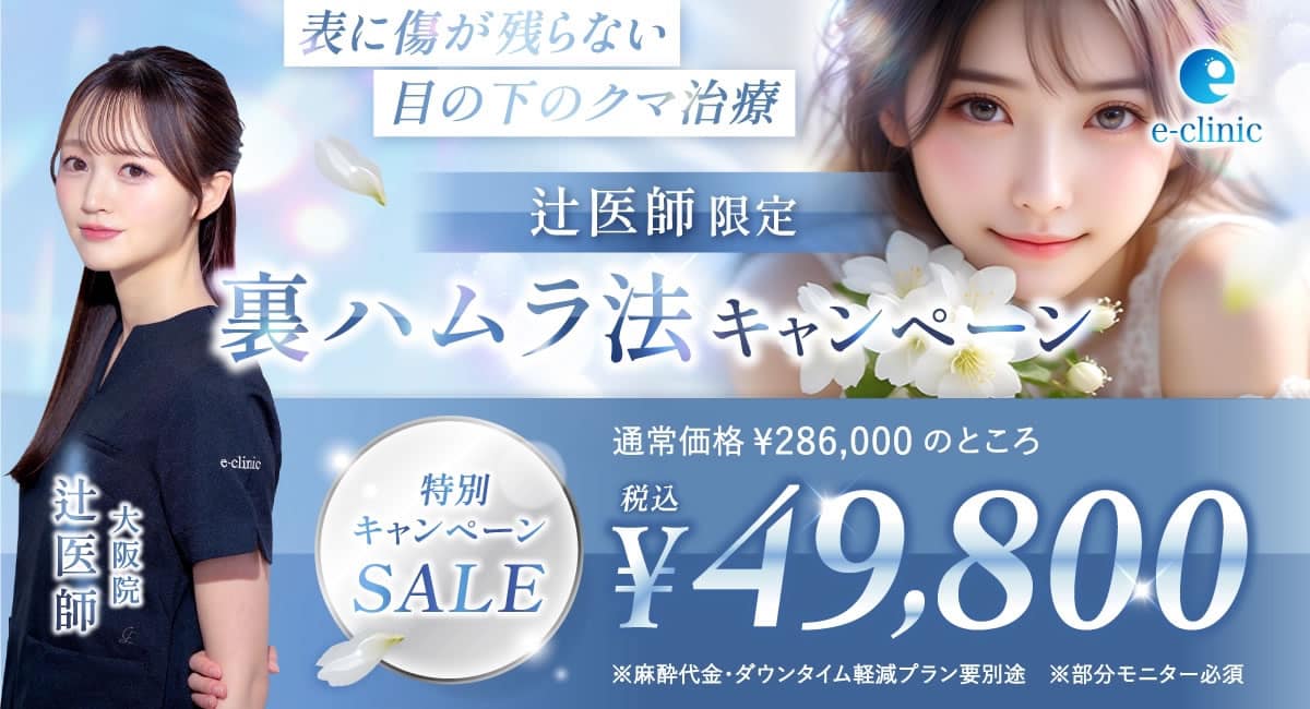 辻医師の裏ハムラ法のキャンペーン