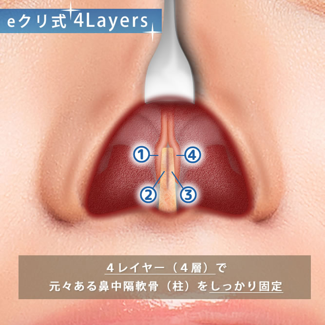 eクリ式4レイヤー