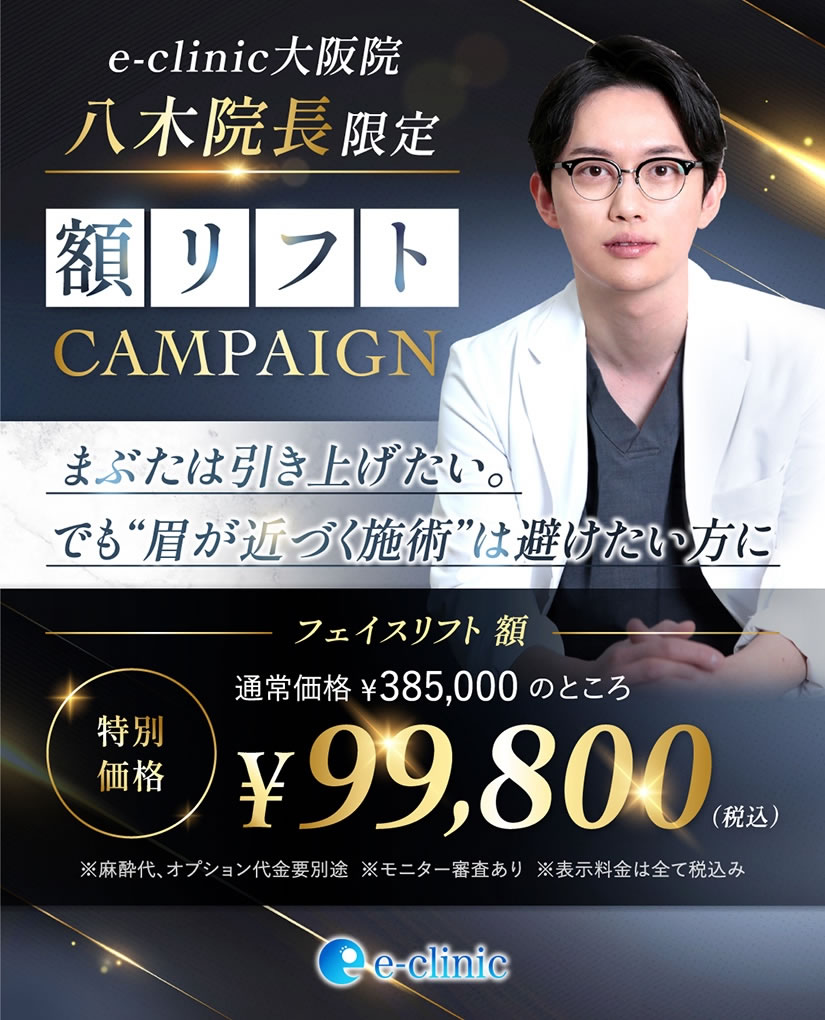 八木医師の額リフトのバナー