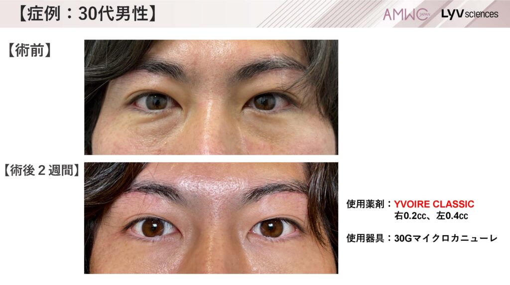 20_症例：30代男性