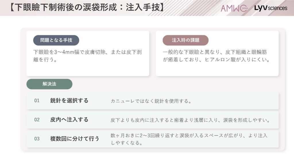 21_下眼瞼下制術後の涙袋形成：注入手技